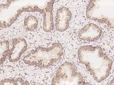 Immunohistochemistry: COQ2 Antibody [NBP3-05834] - Immunochemical staining of human COQ2 in human prostate with rabbit polyclonal antibody at 1:100 dilution, formalin-fixed paraffin embedded sections.