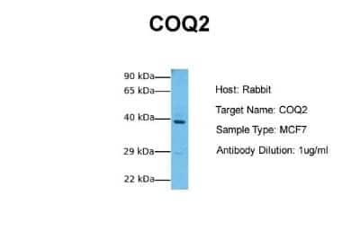 Western Blot: COQ2 Antibody [NBP1-59613] - Sample Tissue: Human MCF7 Antibody Dilution: 1.0 ug/ml