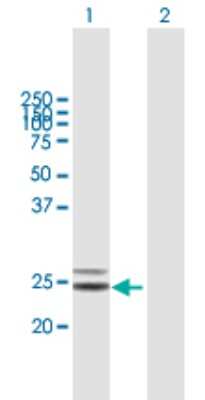 Western Blot: COQ4 Antibody [H00051117-B01P] - Analysis of COQ4 expression in transfected 293T cell line by COQ4 polyclonal antibody.  Lane 1: COQ4 transfected lysate(29.15 KDa). Lane 2: Non-transfected lysate.