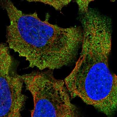 Immunocytochemistry/Immunofluorescence: COQ7 Antibody [NBP2-57950] - Staining of human cell line U-2 OS shows localization to plasma membrane.