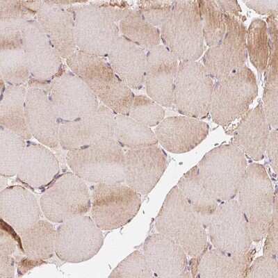 Immunohistochemistry-Paraffin: COQ7 Antibody [NBP2-39084] - Staining of human skeletal muscle shows moderate cytoplasmic positivity in myocytes.