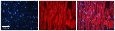 Immunohistochemistry-Paraffin: COQ9 Antibody [NBP2-82739] - Rabbit Anti-COQ9 Antibody. Formalin Fixed Paraffin Embedded Tissue: Human heart Tissue. Observed Staining: Cytoplasmic. Primary Antibody Concentration: 1:100. Other Working Concentrations: N/A. Secondary Antibody: Donkey anti-Rabbit-Cy3. Secondary Antibod