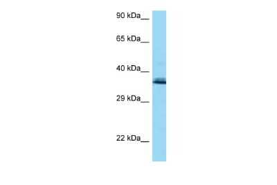 Western Blot COQ9 Antibody