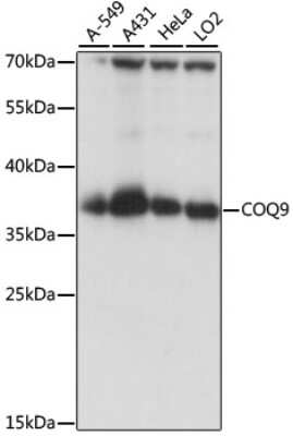 Western Blot: COQ9 Antibody [NBP2-92239] - Analysis of extracts of various cell lines, using COQ9 at 1:1000 dilution.Secondary antibody: HRP Goat Anti-Rabbit IgG (H+L) at 1:10000 dilution.Lysates/proteins: 25ug per lane.Blocking buffer: 3% nonfat dry milk in TBST.Detection: ECL Basic Kit .Exposure time: 10s.