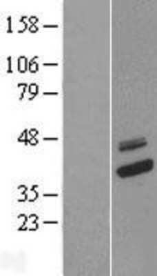 Western Blot: COQ9 Overexpression Lysate (Adult Normal) [NBL1-09393] Left-Empty vector transfected control cell lysate (HEK293 cell lysate); Right -Over-expression Lysate for COQ9.