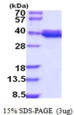 SDS-PAGE Recombinant Human COQ9 His Protein