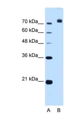 Western Blot Corin Antibody