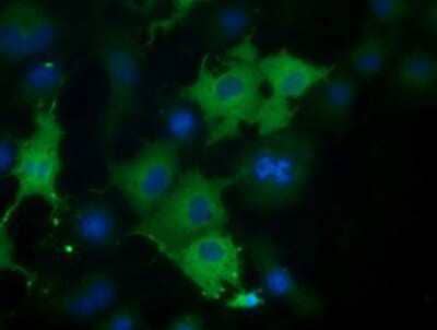 Immunocytochemistry/Immunofluorescence: CORO1B Antibody (3D10) [NBP2-02902] - Staining of COS7 cells transiently transfected by pCMV6-ENTRY CORO1B.