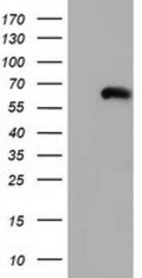 Western Blot: CORO1B Antibody (3D10) [NBP2-02902] - HEK293T cells were transfected with the pCMV6-ENTRY control (Left lane) or pCMV6-ENTRY CORO1B (Right lane) cDNA for 48 hrs and lysed. Equivalent amounts of cell lysates (5 ug per lane) were separated by SDS-PAGE and immunoblotted with anti-CORO1B.