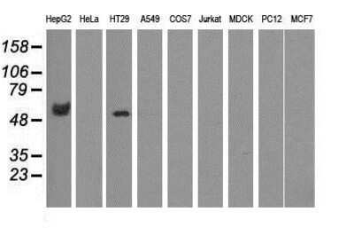 Western Blot: CORO1B Antibody (3D10) [NBP2-02902] Analysis of extracts (35ug) from 9 different cell lines by using anti-CORO1B monoclonal antibody.