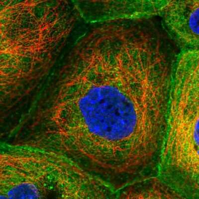 Immunocytochemistry/Immunofluorescence: CORO1B Antibody [NBP2-55203] - Staining of human cell line A-431 shows localization to plasma membrane & cytosol.