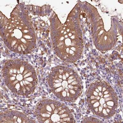 Immunohistochemistry-Paraffin: CORO1B Antibody [NBP2-49634] - Staining of human colon shows moderate cytoplasmic and membranous positivity in glandular cells.