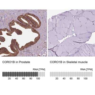 Immunohistochemistry-Paraffin: CORO1B Antibody [NBP2-49634] - Analysis in human prostate and skeletal muscle tissues using NBP2-49634 antibody. Corresponding CORO1B RNA-seq data are presented for the same tissues.