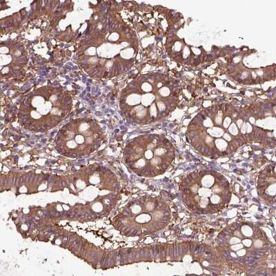 Immunohistochemistry-Paraffin: CORO1B Antibody [NBP2-49634] - Staining of human Colon shows moderate cytoplasmic positivity in glandular cells.