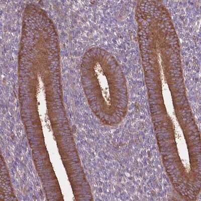 Immunohistochemistry-Paraffin: CORO1B Antibody [NBP2-49634] - Staining of human Endometrium shows strong cytoplasmic positivity in glandular cells.