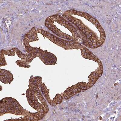 Immunohistochemistry-Paraffin: CORO1B Antibody [NBP2-49634] - Staining of human Prostate shows strong cytoplasmic positivity in glandular cells.