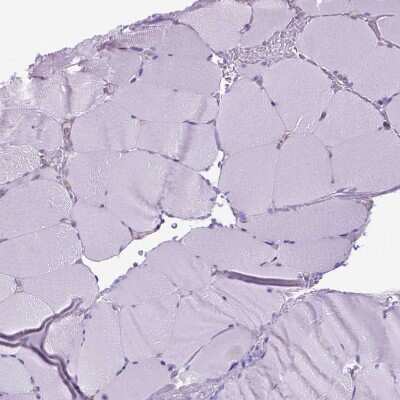 Immunohistochemistry-Paraffin: CORO1B Antibody [NBP2-49634] - Staining of human Skeletal muscle shows no positivity in myocytes.