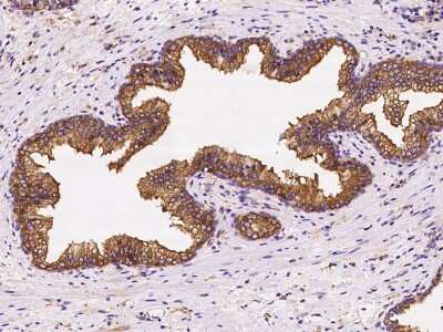 Immunohistochemistry-Paraffin: CORO1B Antibody [NBP2-98597] - Immunochemical staining of human CORO1B in human prostate with rabbit polyclonal antibody at 1:2000 dilution, formalin-fixed paraffin embedded sections.