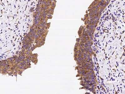 Immunohistochemistry-Paraffin: CORO1B Antibody [NBP2-98597] - Immunochemical staining of human CORO1B in human urinary bladder with rabbit polyclonal antibody at 1:2000 dilution, formalin-fixed paraffin embedded sections.