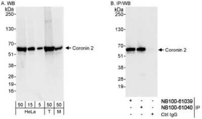 Western Blot CORO1B Antibody