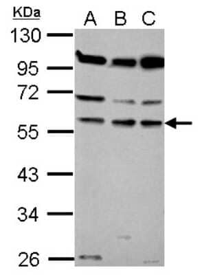 Western Blot: CORO1B Antibody [NBP2-15965] - Sample (30 ug of whole cell lysate) A: NIH-3T3 B: JC C: BCL-1 10% SDS PAGE gel, diluted at 1:1000.