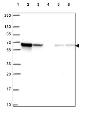 Western Blot: CORO1B Antibody [NBP2-49634] - Lane 1: Marker [kDa] 250, 130, 95, 72, 55, 36, 28, 17, 10Lane 2: Human cell line RT-4Lane 3: Human cell line U-251 MGLane 4: Human plasmaLane 5: Human Liver tissueLane 6: Human Tonsil tissue