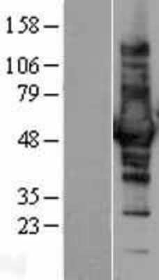 Western Blot CORO1B Overexpression Lysate