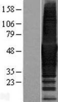 Western Blot CORO1B Overexpression Lysate