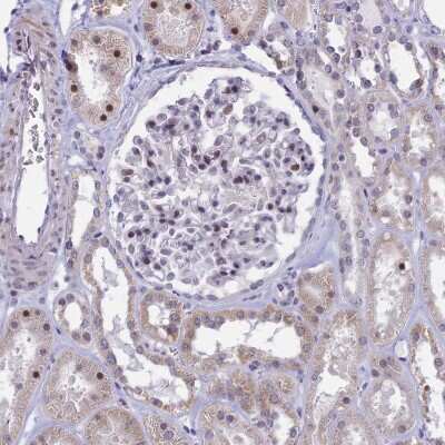 Immunohistochemistry-Paraffin CORO2A Antibody - BSA Free