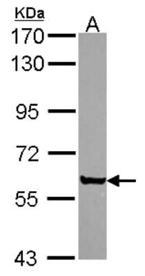 Western Blot: CORO2A Antibody [NBP2-15967] - Sample (30 ug of whole cell lysate) A: JurKat 7. 5% SDS PAGE gel, diluted at 1:1000.