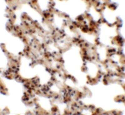 Immunohistochemistry CORO7 Antibody - BSA Free