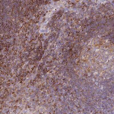 Immunohistochemistry-Paraffin: CORO7 Antibody [NBP2-33687] - Staining of human tonsil shows strong cytoplasmic positivity in non-germinal center cells.