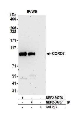 Immunoprecipitation: CORO7 Antibody [NBP2-60707] - Detection of human CORO7 by western blot of immunoprecipitates. Samples: Whole cell lysate (0.5 or 1.0 mg per IP reaction; 20% of IP loaded) from HeLa cells prepared using NETN lysis buffer. Antibodies: Affinity purified rabbit anti-CORO7 antibody NBP2-60707 used for IP at 20 ul per reaction. CORO7 was also immunoprecipitated by rabbit anti-CORO7 antibody NBP2-60706. For blotting immunoprecipitated CORO7, NBP2-60707 was used at 1:250. Detection: Chemiluminescence with an exposure time of 30 seconds.