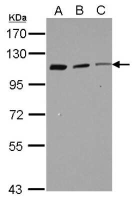 Western Blot: CORO7 Antibody [NBP2-14916] - Sample (30 ug of whole cell lysate) A: Raji B: K562 C: THP-1 7.5% SDS PAGE; antibody diluted at 1:1000.