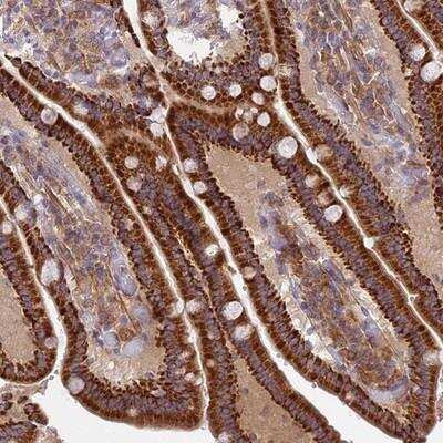 Immunohistochemistry-Paraffin: CORO7-PAM16 Antibody [NBP1-93946] - Staining of human duodenum shows strong cytoplasmic positivity in glandular cells.