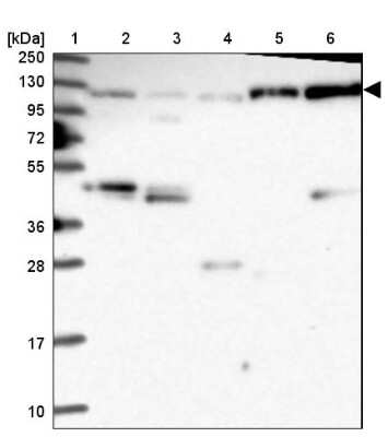 Western Blot: CORO7-PAM16 Antibody [NBP1-93946] - Lane 1: Marker  [kDa] 250, 130, 95, 72, 55, 36, 28, 17, 10.  Lane 2: Human cell line RT-4.  Lane 3: Human cell line U-251MG sp.  Lane 4: Human plasma (IgG/HSA depleted).  Lane 5: Human liver tissue.  Lane 6: Human tonsil tissue