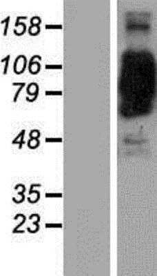 Western Blot: CORO7 Overexpression Lysate [NBP2-06324] - Left-Empty vector transfected control cell lysate (HEK293 cell lysate); Right -Over-expression Lysate for CORO7