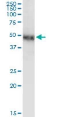 Western Blot: COUP-TF I/NR2F1 Antibody (1A4) [H00007025-M01] - NR2F1 monoclonal antibody (M01), clone 1A4. Analysis of NR2F1 expression in human placenta.