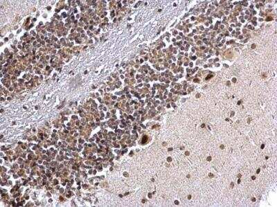 Immunohistochemistry-Paraffin: COUP-TF I/NR2F1 Antibody [NBP1-31259] - Mouse hind brain. COUP TF1 antibody [N1], N-term diluted at 1:500. Antigen Retrieval: Trilogy™ (EDTA based, pH 8.0) buffer, 15min. 