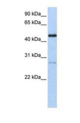 Western Blot: COUP-TF I/NR2F1 Antibody [NBP1-52831] - Titration: 0.2-1 ug/ml, Positive Control: Transfected 293T.