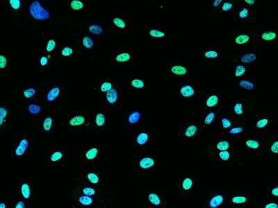 Immunocytochemistry/Immunofluorescence: COUP-TF II/NR2F2 Antibody [NBP2-98861] - Immunofluorescence staining of COUP-TF II/NR2F2 in HUVEC cells. Cells were fixed with 4% PFA, permeabilzed with 0.3% Triton X-100 in PBS, blocked with 10% serum, and incubated with rabbit anti- COUP-TF II/NR2F2 polyclonal antibody (1:5000) at 4C overnight. Then cells were stained with the Alexa Fluor(R)488-conjugated Goat Anti-rabbit IgG Secondary antibody (green) and counterstained with DAPI (blue). Positive staining was localized to nucleus.