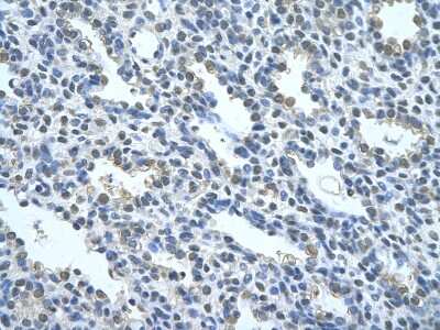 Immunohistochemistry-Paraffin: COUP-TF II/NR2F2 Antibody [NBP3-10876] - Immunohistochemical analysis of paraffin-embedded human alveolar cell tissue.