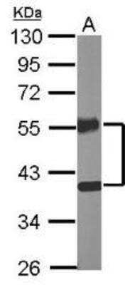 Western Blot: COUP-TF II/NR2F2 Antibody [NBP1-31980] - Sample (20 ug of whole cell lysate)   A: Mouse brain   10% SDS PAGE; antibody diluted at 1:10000