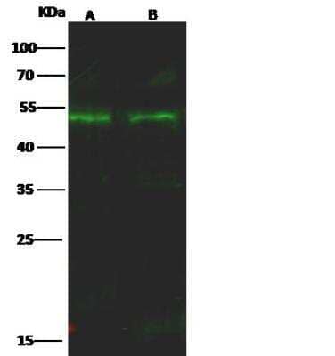 Western Blot: COUP-TF II/NR2F2 Antibody [NBP2-98861] - Lane A: MCF7 Whole Cell LysateLane B: HEK293 Whole Cell LysateLysates/proteins at 30 ug per lane.SecondaryGoat Anti-Rabbit IgG H&L (Dylight800) at 1/10000 dilution.Developed using the Odyssey technique.Performed under reducing conditions.Predicted band size:46 kDaObserved band size:50 kDa