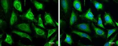 Immunocytochemistry/Immunofluorescence: COX IV Isoform 2 Antibody [NBP3-13152] - COX IV Isoform 2 antibody detects COX IV Isoform 2 protein at mitochondria by immunofluorescent analysis. Sample: HeLa cells were fixed in 4% paraformaldehyde at RT for 15 min. Green: COX IV Isoform 2 stained by COX IV Isoform 2 antibody (NBP3-13152) diluted at 1:1000. Blue: Hoechst 33342 staining. Scale bar= 10um.