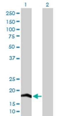 Western Blot: COX IV Isoform 2 Antibody [H00084701-D01P] - Analysis of COX4I2 expression in transfected 293T cell line by COX4I2 polyclonal antibody.Lane 1: COX4I2 transfected lysate(20.00 KDa).Lane 2: Non-transfected lysate.