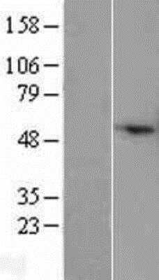 Western Blot: COX IV Isoform 2 Overexpression Lysate (Native) [NBP2-05989] - COX IV Isoform 2 Overexpression Lysate (Native) Left-Empty vector transfected control cell lysate (HEK293 cell lysate); Right -Over-expression Lysate for COXIV Isoform 2.