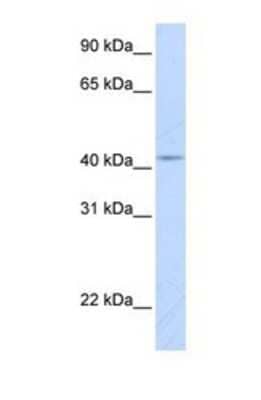 Western Blot: COX10 Antibody [NBP1-59554] - This Anti-COX10 antibody was used in Western Blot of Fetal Lung tissue lysate at a concentration of 1ug/ml.