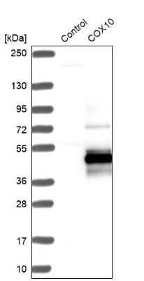 Western Blot: COX10 Antibody [NBP1-86323] - Analysis in control (vector only transfected HEK293T lysate) and COX10 over-expression lysate (Co-expressed with a C-terminal myc-DDK tag (3.1 kDa) in mammalian HEK293T cells).