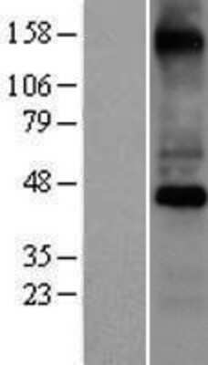 Western Blot: COX10 Overexpression Lysate (Adult Normal) [NBP2-08219] Left-Empty vector transfected control cell lysate (HEK293 cell lysate); Right -Over-expression Lysate for COX10.